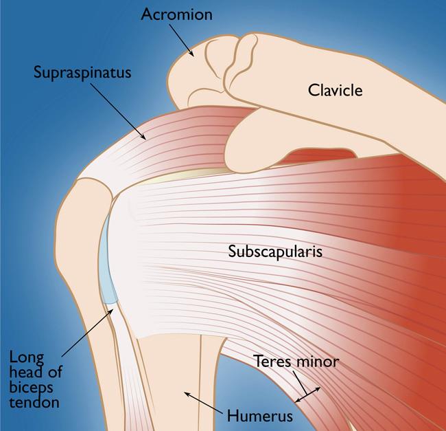 Rotator Cuff Tears